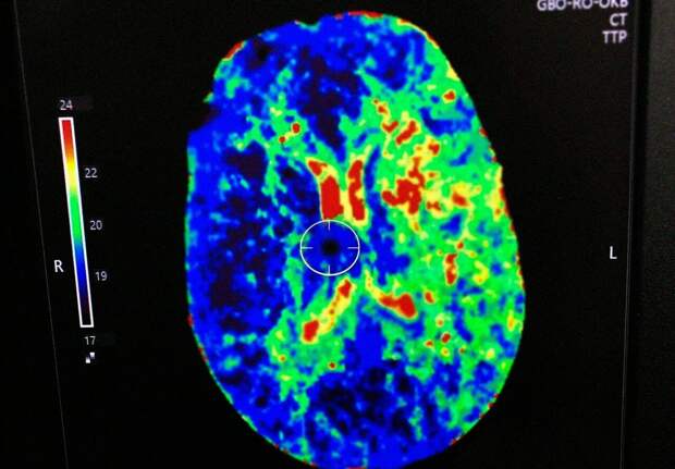 В Рязанской ОКБ пациенту помогли восстановить речь после инсульта