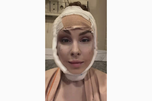 Жена Natan показала результат пластики за миллион рублей