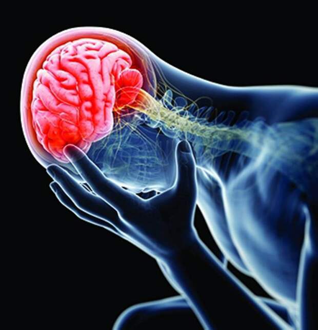 Классификация головной боли: описание, клинические проявления