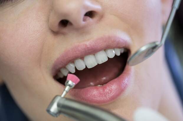 Зубная боль у жительницы Самарской области оказалась симптомом онкологии
