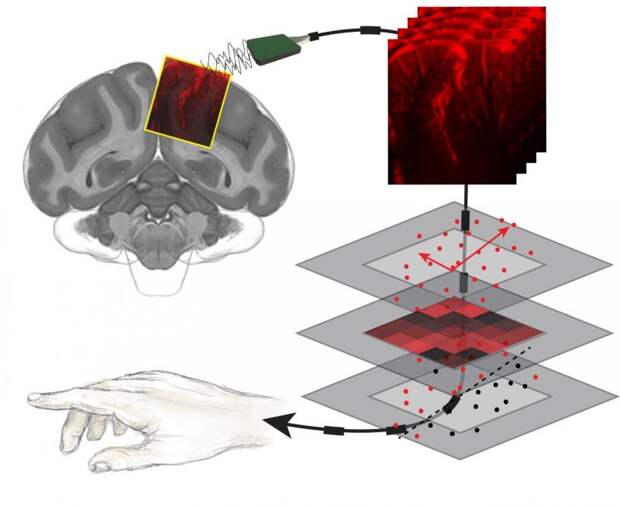 brain-machine interface ultrasound