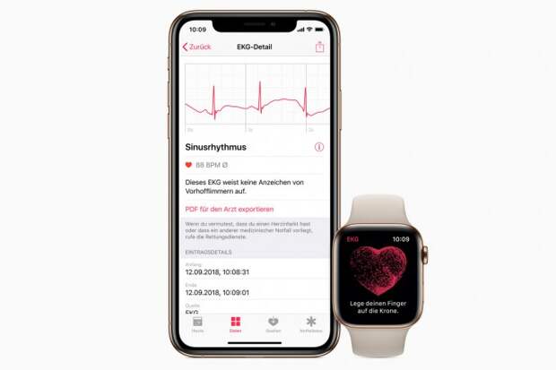 У европейцев появилась функция ЭКГ в Apple Watch (3 фото)