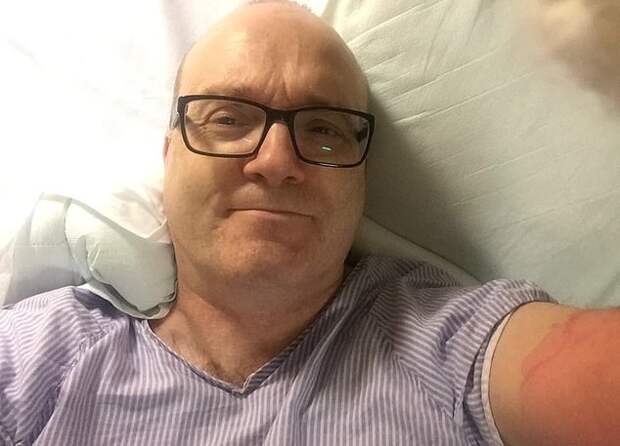 Милый пёсель едва не убил хозяина и почти лишил руки. Но он его даже не кусал - было достаточно одной царапины