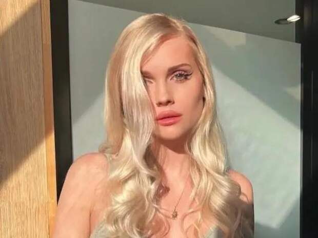 «Мозг не реагирует»: что сейчас с моделью Екатериной Блиновой, впавшей в кому