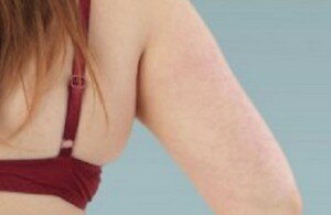 7 частей тела, которые указывают на лишний вес