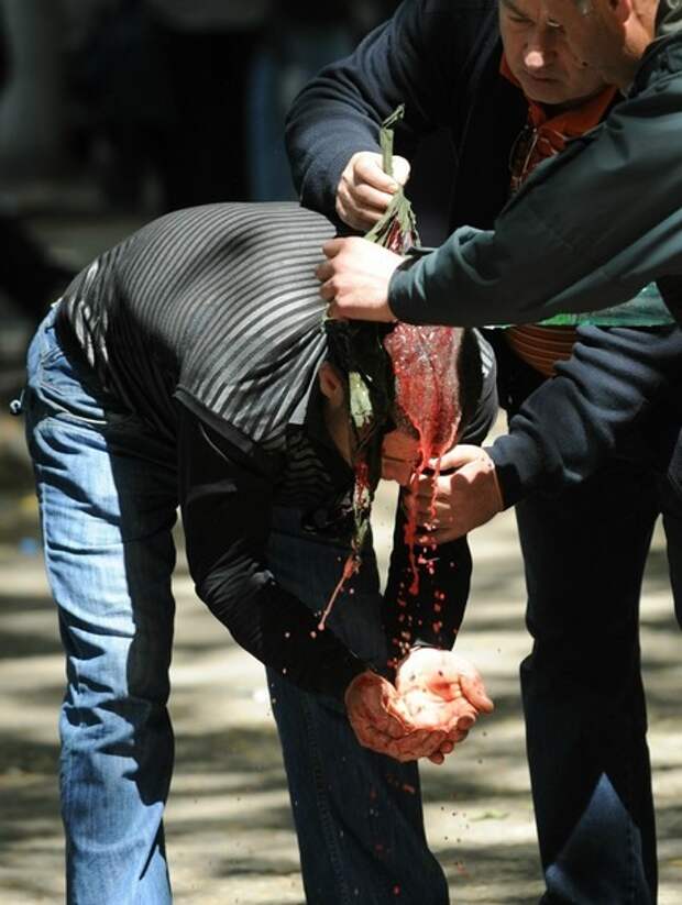 Georgian opposition activists help a man