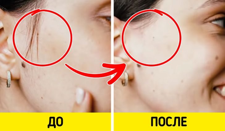 Ингредиенты, которые помогут избавиться от волос на лице в домашних условиях