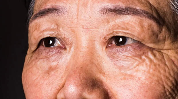 По глазам можно выявить опасную болезнь за 12 лет до первых симптомов