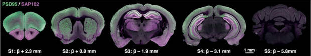 Whole-Brain-Scale Mapping