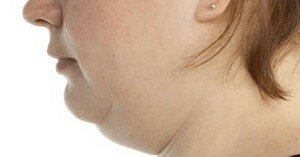 7 частей тела, которые указывают на лишний вес