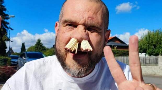 Мужчина со спичками в носу / Фото: 