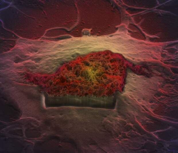Мозговые клетки наука, фото