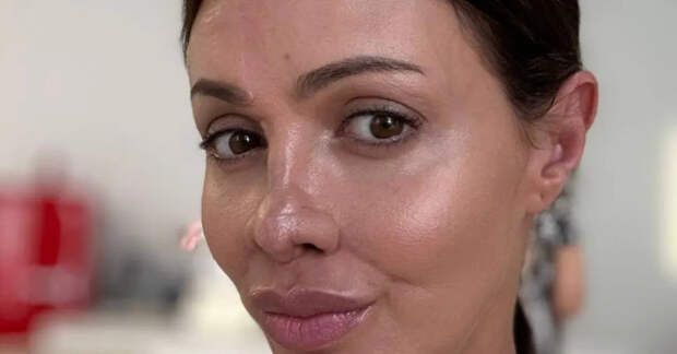 Экс-супруга Аршавина раскрыла детали заболевания, из-за которого лишилась носа