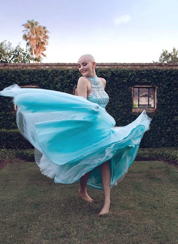 Спустя год после потери волос из-за рака, девушка вернулась и она полностью преобразилась болезнь, в мире, волосы, девушка, лечение, люди, рак, сила воли