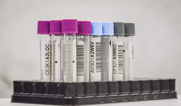 За сутки на севере Карелии коронавирусом заболели более 60 человек