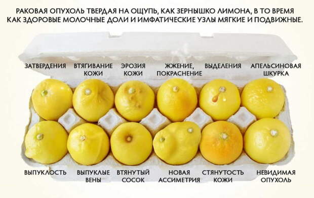 Гипертония и повышенная масса тела - частые причины рака груди! Самый опасный возраст - до 30 и после 60 лет