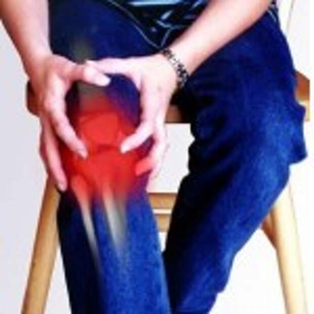 arthritis of joints. Лечение артрита народными средствами