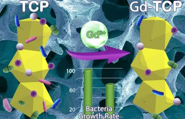 Российские ученые разработали особо прочные имплантаты
