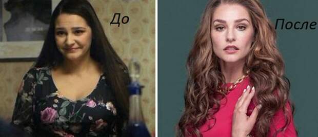 Глафира тарханова похудела фото до и после пластики