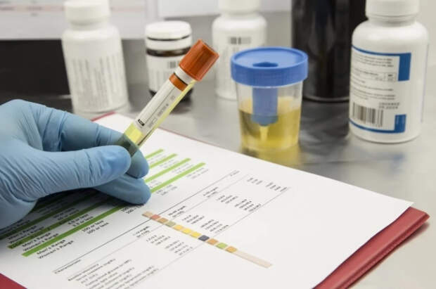 Олимпийскую чемпионку по лыжным гонкам отстранили на 1,5 года за допинг