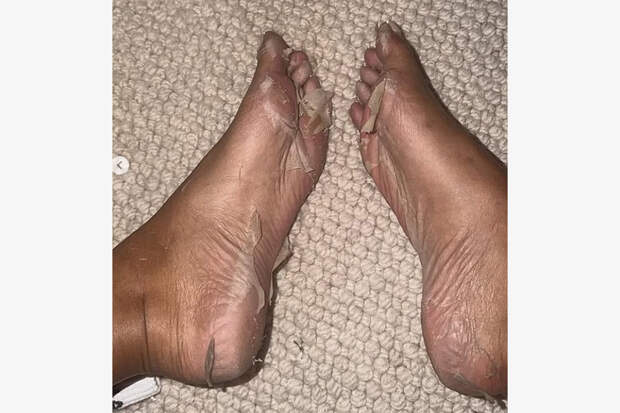 Звезда с самыми идеальными ягодицами смутила публику ступнями на фото в бикини