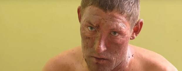 В Симферополе скончалась девушка, которую поджёг ревнивый парень 2