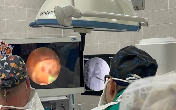 В Рязани пациентке удалили коралловидный камень из почки эндоскопическим методом