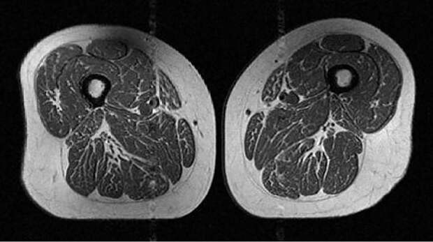 От этой еды ваши мышцы зарастают жиром и превращаются в мраморные стейки