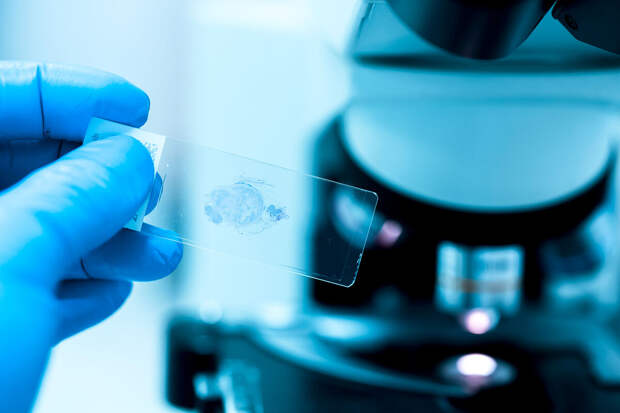 MedX: семь тысяч шагов в день могут снижать риск нескольких видов рака на 16%