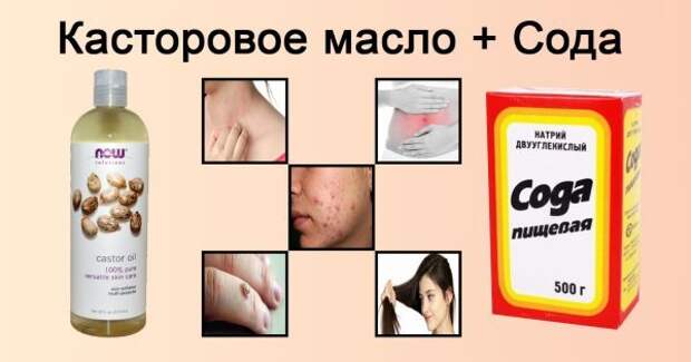 thumb-600x315 (3)