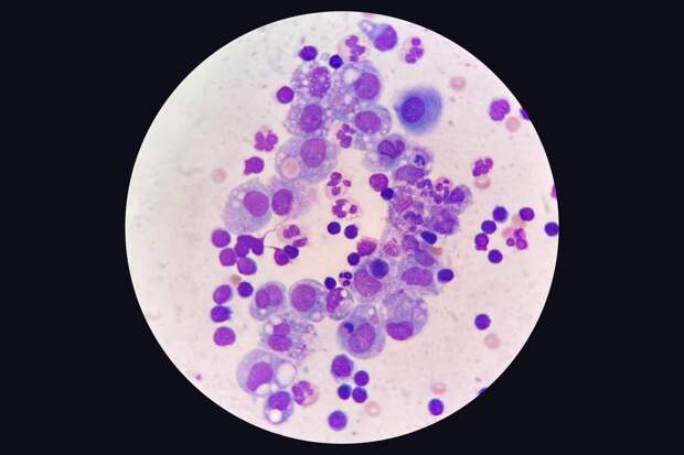 В России открыли способ запуска восстановления тканей