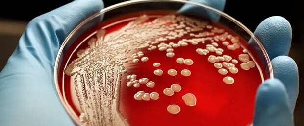 Создан антибиотик, уничтожающий все штаммы резистентного стафилококка
