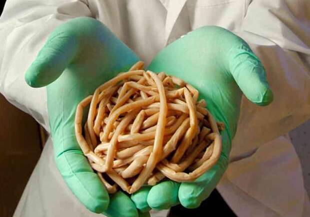 Чем опасно для человека заражение глистами?