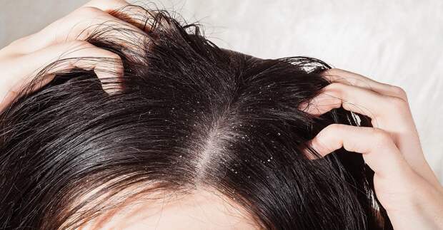 средство от перхоти и выпадения волос