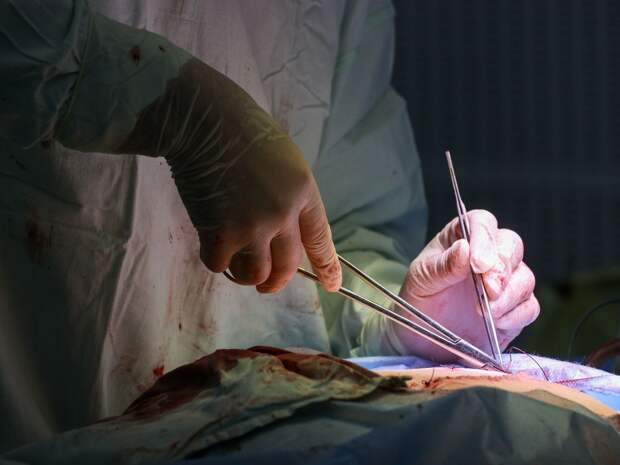 Пациентку с огромной язвой желудка посчастливилось спасти тюменским врачам