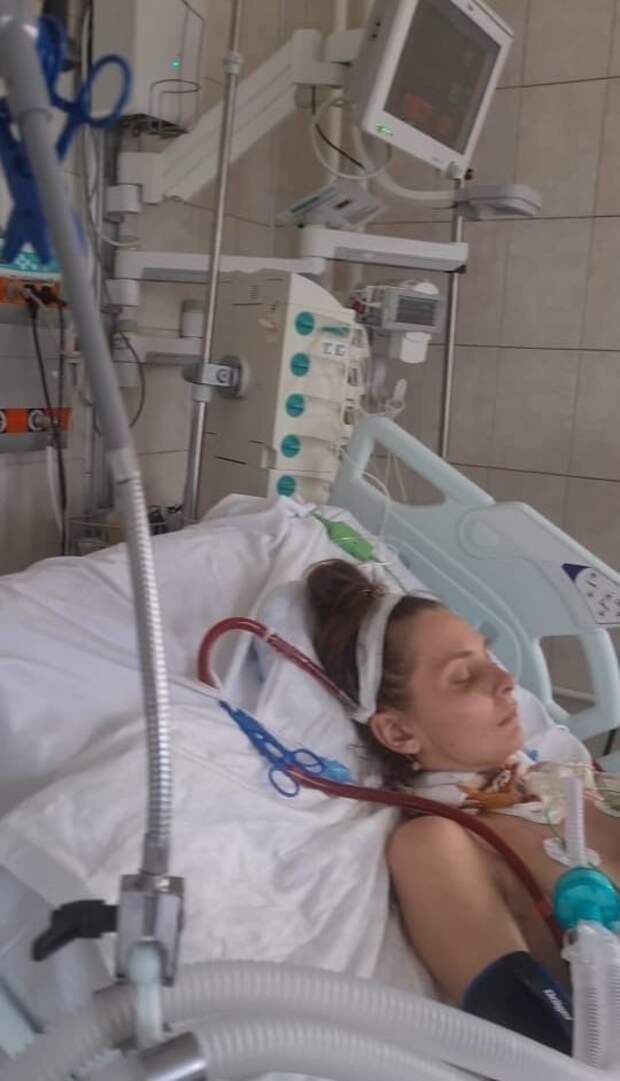 24 марта пациентку доставили в одну из подмосковных больниц с диагнозом двусторонний пиосальпинкс. После проведенного хирургического вмешательства развились осложнения: распространенный перитонит, сепсис, септический шок, острый респираторный дистресс-синдром (ОРДС). Проводилась искусственная вентиляция легких, постсиндромальная терапия — без эффекта. Дыхательная недостаточность прогрессировала, ИВЛ не справлялось.