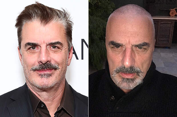 Крис Нот побрился налысо (его партнерша по сериалу "Секс в большом городе" Сара Джессика Паркер прокомментировала)