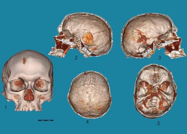 У сунгирца оказались хорошо развиты затылочные доли головного мозга