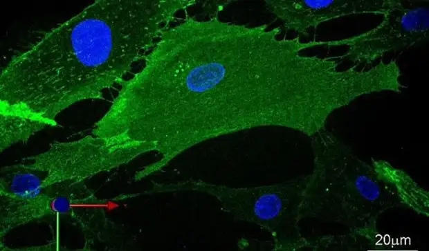 Кембриджские ученые разрабатывают новую методику омоложения клеток