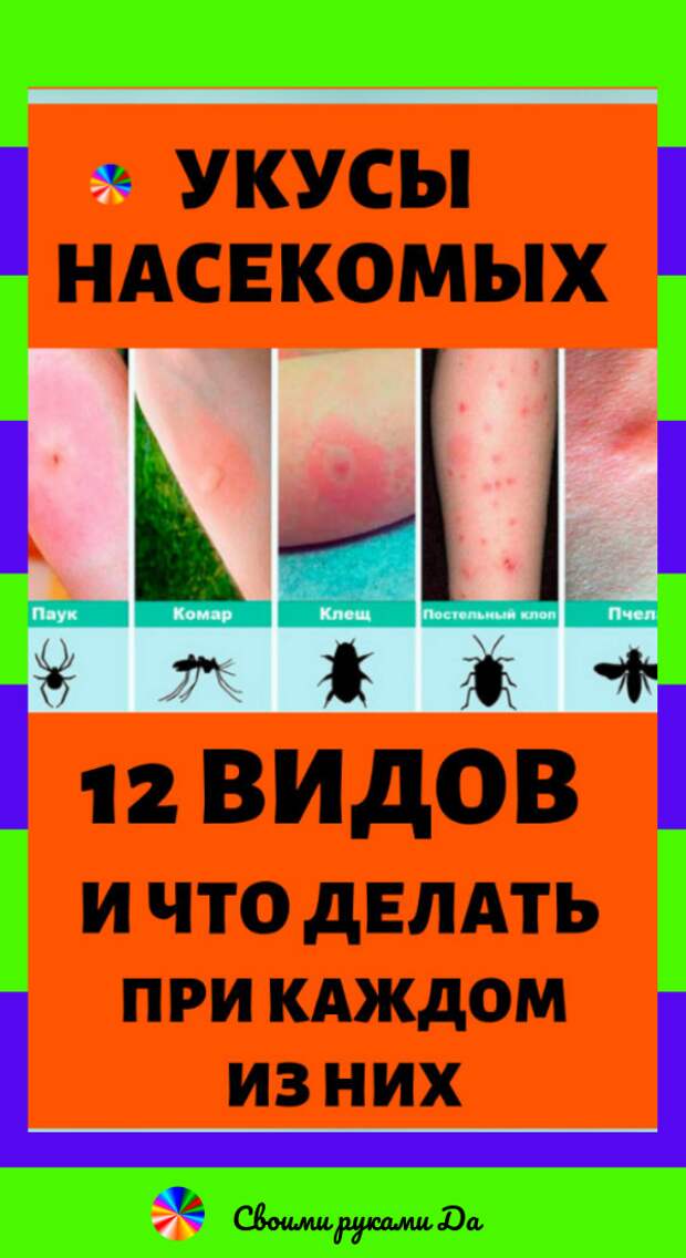 Укусы насекомых: 12 видов и что делать при каждом из них в домашних условиях + народные рецепты