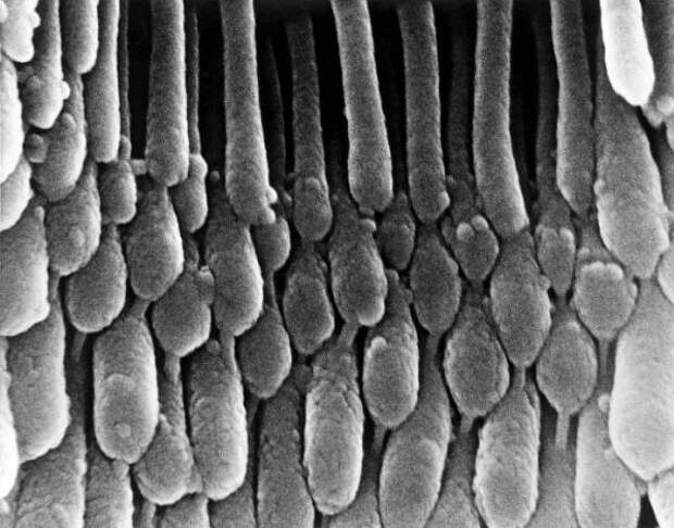 Картинки по запросу Волоски в ухе под микроскопом