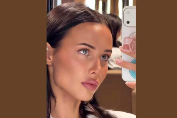 Решетова показала внешность после удаления филлера из губ