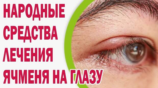 Домашний способ быстрого лечения ячменя