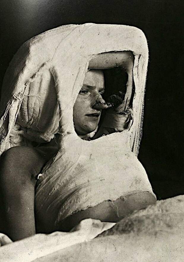 Пугающие портреты пациентов с аномалиями 19-го века