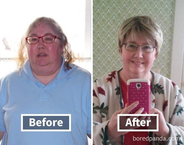 9. Минус 25 кг за год До и после похудения, до и после, похудание, похудели, похудение, сравнение, тогда и сейчас