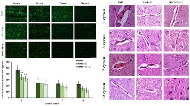 Учёные Лобачевского восстановили функции мозга после ЧМТ с помощью молекулярного водорода