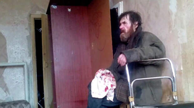 Бездомный, избитый подростками в Воронеже 
