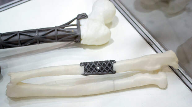 Российские ученые разработали "цифровой конструктор" для создания искусственных костей