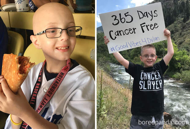 Люди, которые победили рак, на снимках до и после