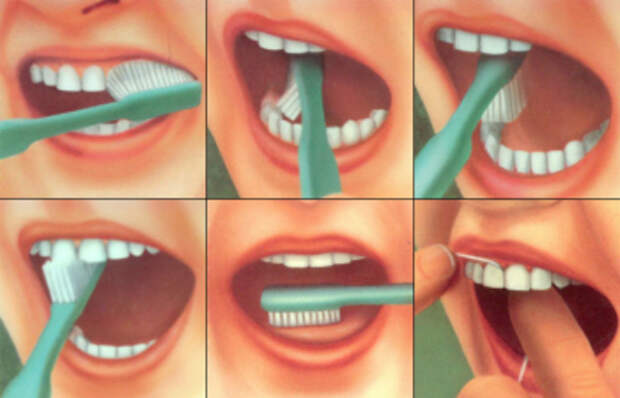 Схема чистки зубов